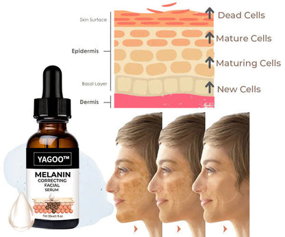 ✨Fast Dark Spot Remover-YAGOO™  Melanin Correcting Facial Serum(🔥Last Day Promotion 60% OFF)