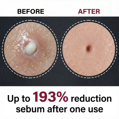 🔥The last 3 hours-Buy two get one free-Tiworld™ Luxury Rice Bran Ampoules