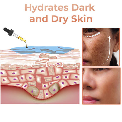 ✨Fast Dark Spot Remover-YAGOO™  Melanin Correcting Facial Serum(🔥Last Day Promotion 60% OFF)
